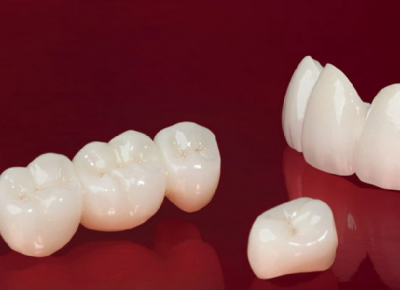 Dán sứ thẩm mỹ Dán sứ thẩm mỹ