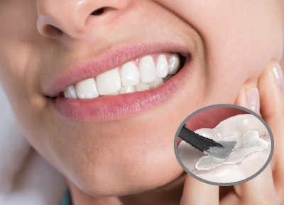 Trám răng Trám răng