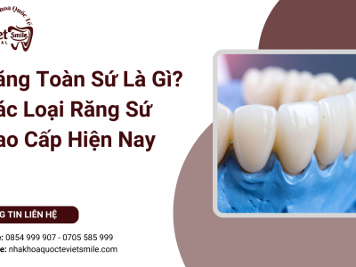 Răng Toàn Sứ Là Gì? Các Loại Răng Sứ Cao Cấp Hiện Nay Răng Toàn Sứ Là Gì? Các Loại Răng Sứ Cao Cấp Hiện Nay