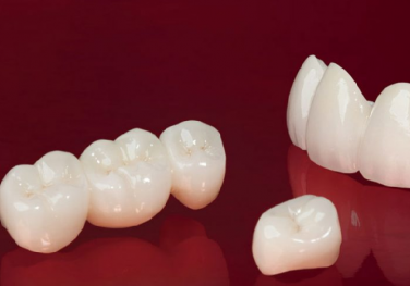 Dán sứ thẩm mỹ Dán sứ thẩm mỹ