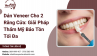 Dán Veneer Cho 2 Răng Cửa: Giải Pháp Thẩm Mỹ Bảo Tồn Tối Đa Dán Veneer Cho 2 Răng Cửa: Giải Pháp Thẩm Mỹ Bảo Tồn Tối Đa