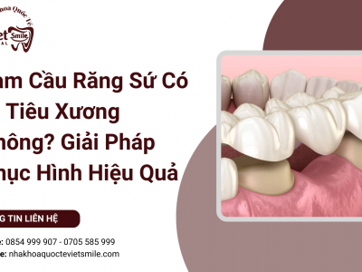 Làm Cầu Răng Sứ Có Bị Tiêu Xương Không? Giải Pháp Phục Hình Hiệu Quả Làm Cầu Răng Sứ Có Bị Tiêu Xương Không? Giải Pháp Phục Hình Hiệu Quả