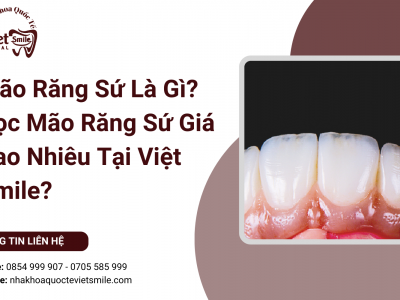 Mão Răng Sứ Là Gì? Bọc Mão Răng Sứ Giá Bao Nhiêu Tại Việt Smile? Mão Răng Sứ Là Gì? Bọc Mão Răng Sứ Giá Bao Nhiêu Tại Việt Smile?