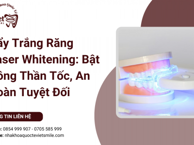 Tẩy Trắng Răng Laser Whitening: Bật Tông Thần Tốc, An Toàn Tuyệt Đối Tẩy Trắng Răng Laser Whitening: Bật Tông Thần Tốc, An Toàn Tuyệt Đối