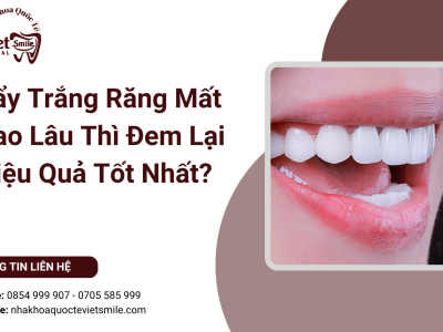 Tẩy Trắng Răng Mất Bao Lâu Thì Đem Lại Hiệu Quả Tốt Nhất? Tẩy Trắng Răng Mất Bao Lâu Thì Đem Lại Hiệu Quả Tốt Nhất?