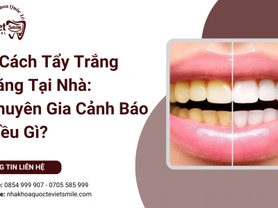 9 Cách Tẩy Trắng Răng Tại Nhà: Chuyên Gia Cảnh Báo Điều Gì? 9 Cách Tẩy Trắng Răng Tại Nhà: Chuyên Gia Cảnh Báo Điều Gì?