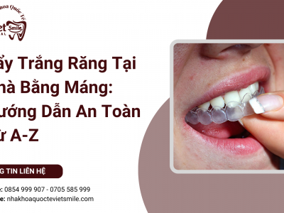 Tẩy Trắng Răng Tại Nhà Bằng Máng: Hướng Dẫn An Toàn Từ A-Z Tẩy Trắng Răng Tại Nhà Bằng Máng: Hướng Dẫn An Toàn Từ A-Z